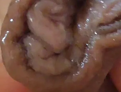 Large Foreskin and Balls in Striking Close-up.