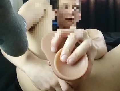 Anal Gaping