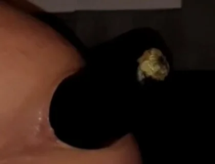 2 Huge Anal Eggplants Insertion ..big Anal Stretching!!