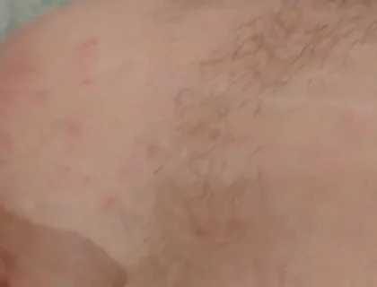 Masturbation