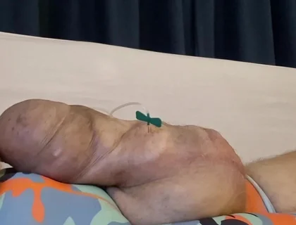 What a Big Obscene Package of Silicone Meat