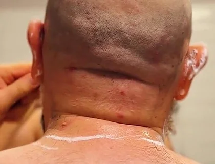Shave Bald Head and Worship