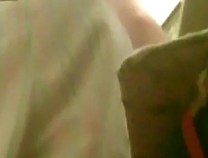 A Young Guy Is Sitting on a Chair with Anal Prolapse