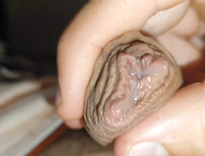 Silent Purge of Straight Scrotal Fluid.