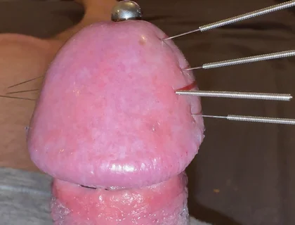 Needles Through the Thick, Hard Glans, Mega Orgasm