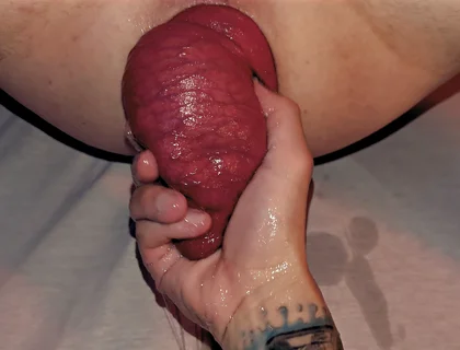 Arty Boer and Prolapsiboy.