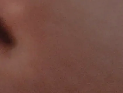 Amazing Closeup of the Widened Hole!!