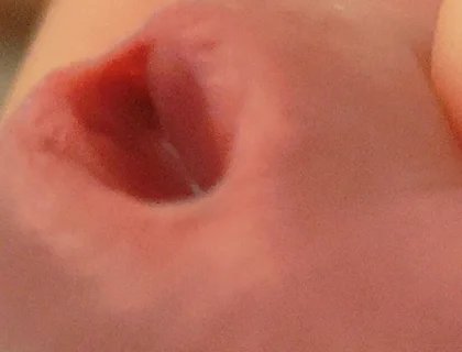 Amazing Closeup of the Widened Hole!!