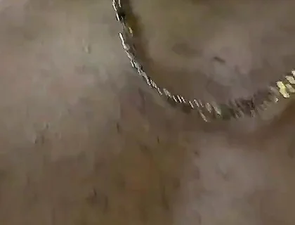 Two Twinkies, Secluded in the Forest