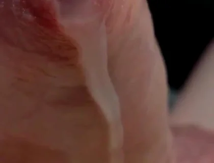 Phimosis Cock Leaking Cum Close-up Hands-free