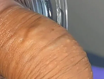 Mysterious Solution Inserted Into the Wrinkled Cock.