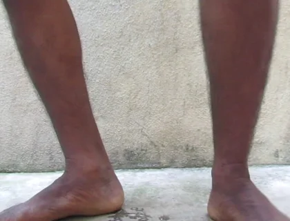 Mature Hairy Indian Cock Hair Removel After Oil Masturbation to Release Cum