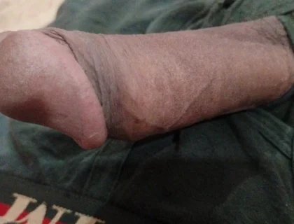 It's so Huge and Tasty.... It's Only for... It's Available for....who Want to Take It