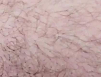 Smoking on the Fist Day 2026