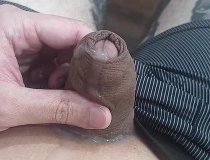 My Penis Won't Stop Spitting Semen