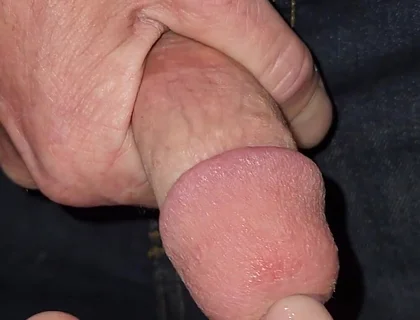 Gaping Urethra - Marker and Pinky Insertion