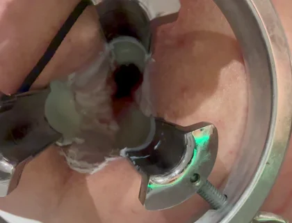 Pouring Hot Candle Wax Into Ass