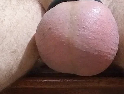 Saline and Masturbation