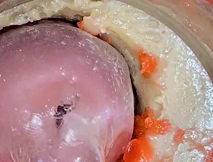 The Camera 4K Inside the Deep Pussy Records a Huge Ejaculation with a Stuck Condom