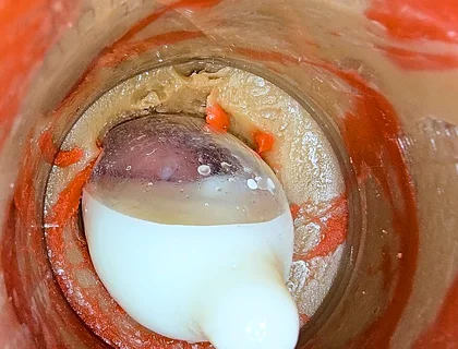 The Camera 4K Inside the Deep Pussy Records a Huge Ejaculation with a Stuck Condom