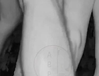 In a Park, at Night, Jules Is Desperate to Pee and Tries to Hide From His Friend but Is Caught on Night Vision Cam