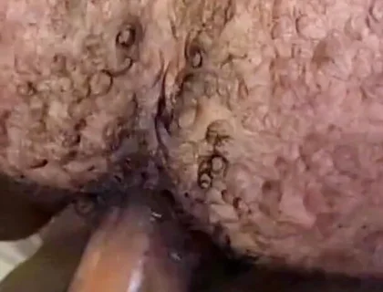 Que Rico Este Culo Peludo Y Tragón