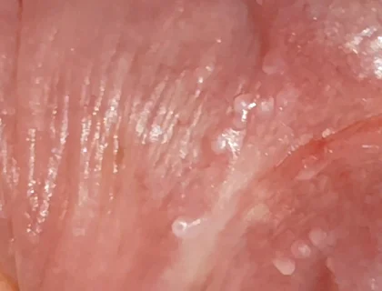 Wide Hole Filled with Pre Cum in Close up