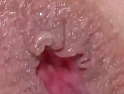 Extreme Closeup Dildo Anal Creampie