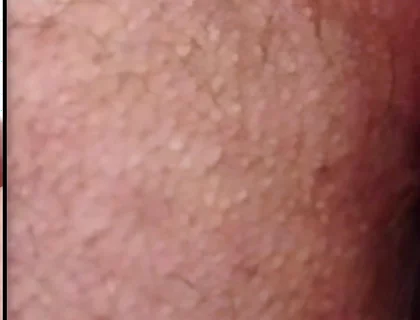 Split-screen Twitching Asshole Dripping with Massive Cum Load