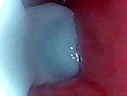 I Couldn’t Believe What Happens Inside the Penis as Sperm Passes Through (endoscopic Footage)