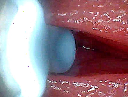 I Couldn’t Believe What Happens Inside the Penis as Sperm Passes Through (endoscopic Footage)