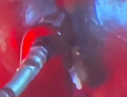 Intense Verbal Play Ahead...