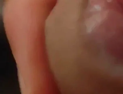 Great Phimosis Getting in the Way of the Boy's Orgasm