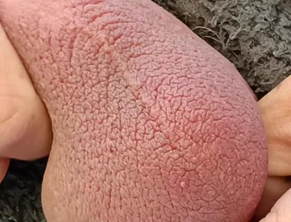 Big Uncut Cock Edging and Cumming, Outdoor Onesie Wank for the Neighbours - Rockardglans