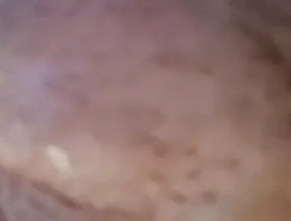 Extreme Fillings Inside My Siliconemeat