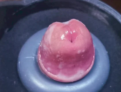 Penis Machine with a New Attachment