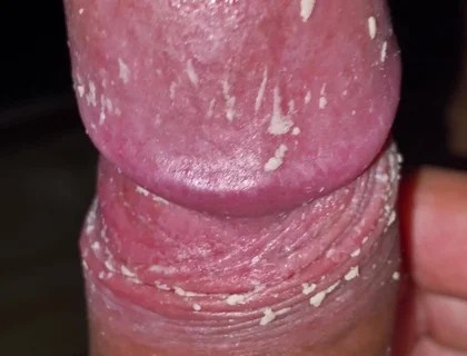 Checking My Dirty Dick