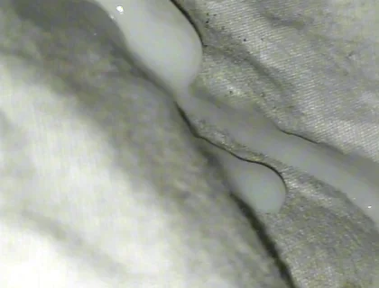 Huge Sperms Out of His Penis, an Young Boy