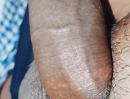 Penis
