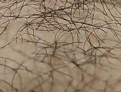 I'm Hairy Boy This My Legs and Dick