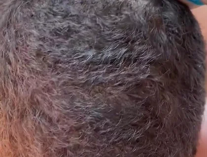 More Sucking