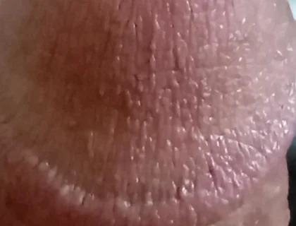 My Dick