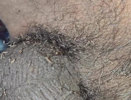 My Bushes Catch Fire Burning Penis Shaved Penis by Fire