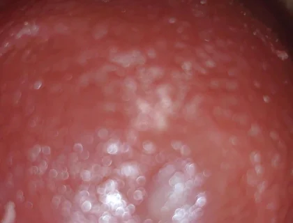 Deep Thrusts Trigger Feverish Cum Inside Without Sperm's Trace