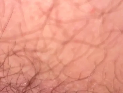 Close up Hairy Hole