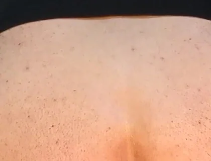 He Enjoys Sucking on His Anal Prolapse