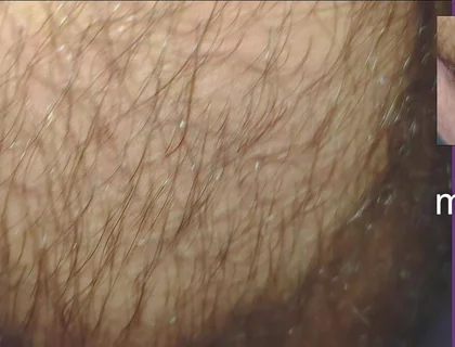 The Texture of the Clothes