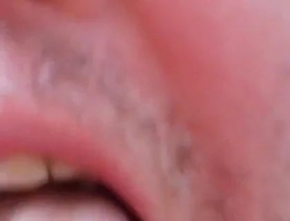 Camera Blunder in the Attempt at Facial Insemination