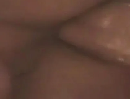 Gaping Anal Prolapse Overflow - Rosebud Pulsing Wide Open