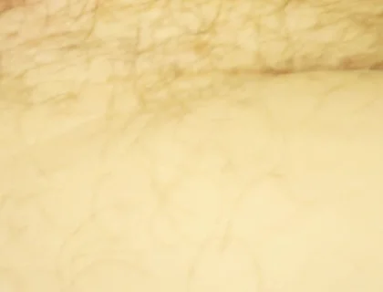 Close up of My Hole